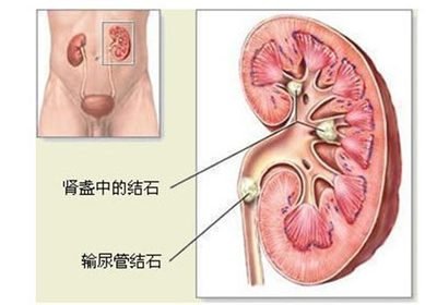 t015f40a543a402f85d.jpg