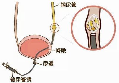 t040187bbc8ee7c1136.jpg